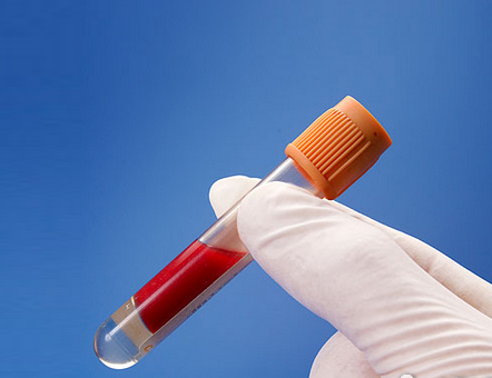 高血脂，隱秘的溫柔殺手