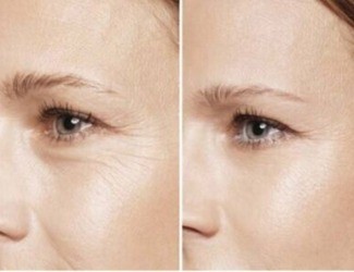 提前衰老、抵抗力差，用熟三七粉，抗衰還能補氣血！